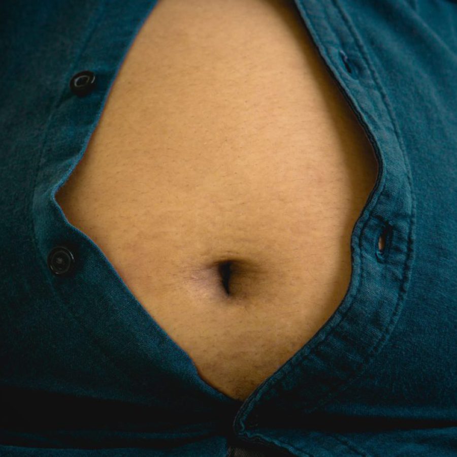 man with overweight.obese man have excessive belly fat; overweight fatty belly of man; man diet lifestyle concept to reduce belly and shape up healthy stomach muscle